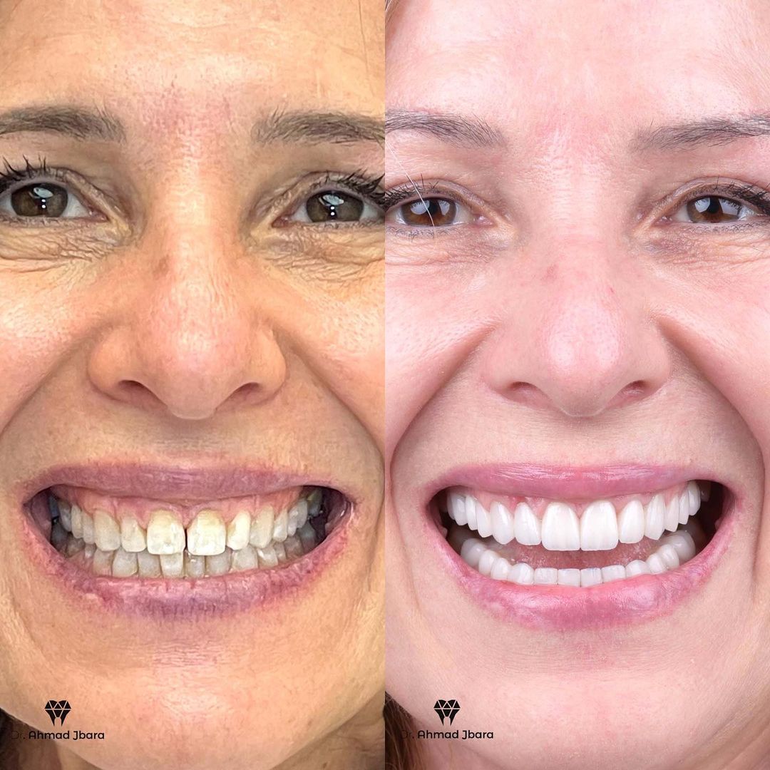 Montana Hier profile picture